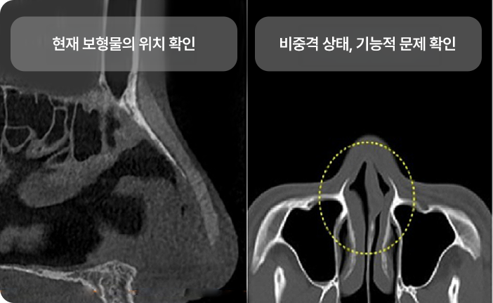 Point Image 2